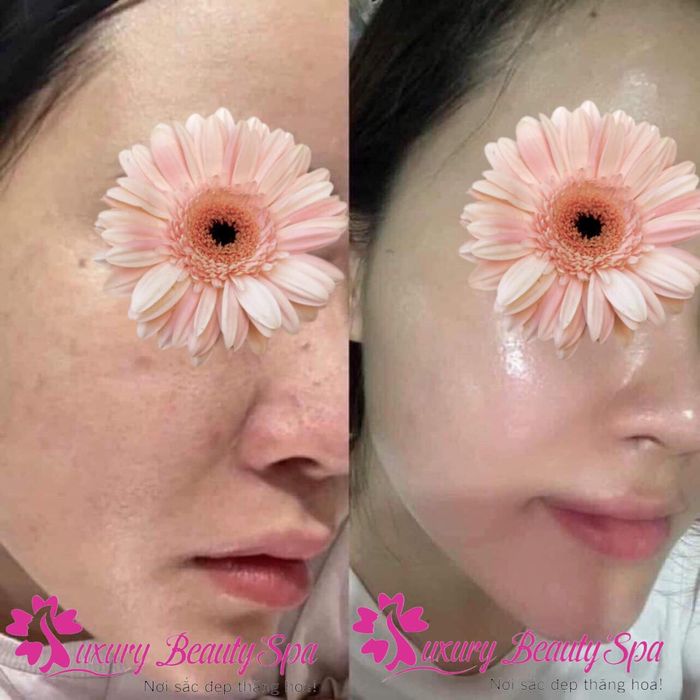 Hình ảnh liệu trình chăm sóc da cao cấp tại Luxury Beauty Spa