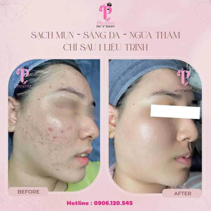 Phoenix Spa & Academy Đà Lạt ảnh 1