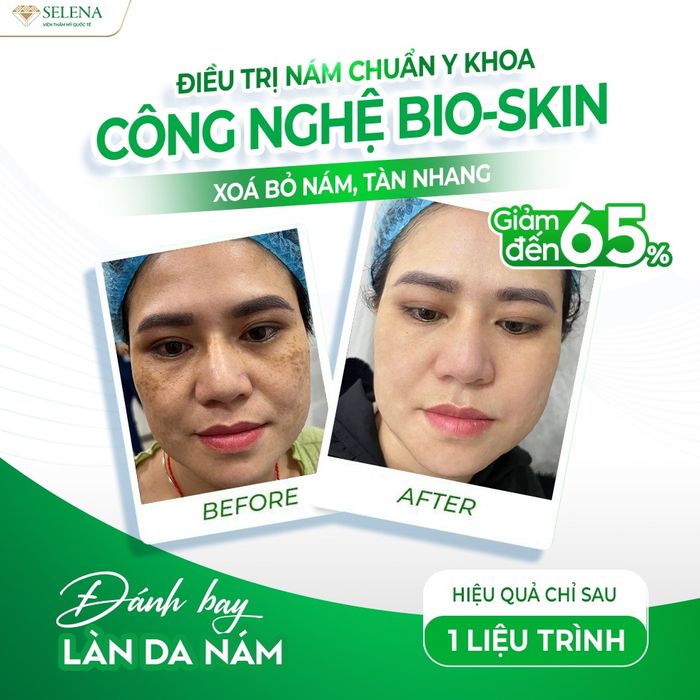Hình ảnh thực tế Selena Spa & Academy Vũng Tàu