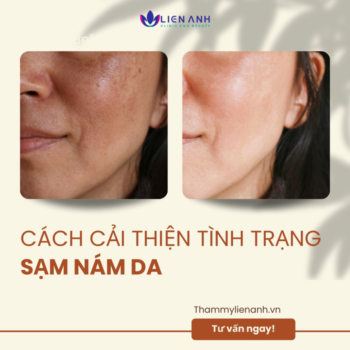 Viện thẩm mỹ công nghệ cao Liên Anh ảnh 2