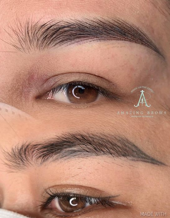 Hình ảnh kết quả xóa xăm ấn tượng tại Phước Lai PMU Beauty Academy