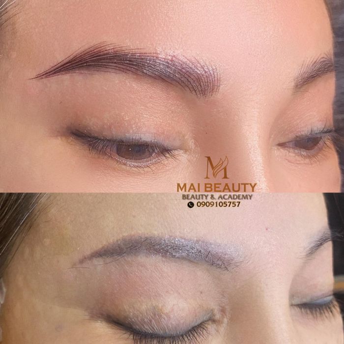 Hình ảnh thực tế quy trình xóa xăm tại Mai Beauty Brows Vũng Tàu