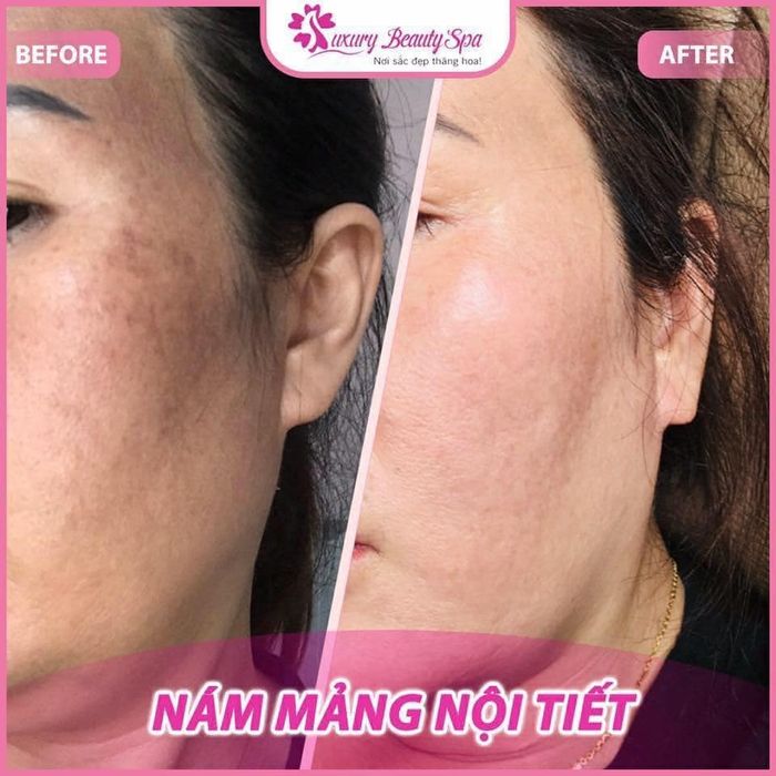 Không gian sang trọng đẳng cấp tại Luxury Beauty Spa