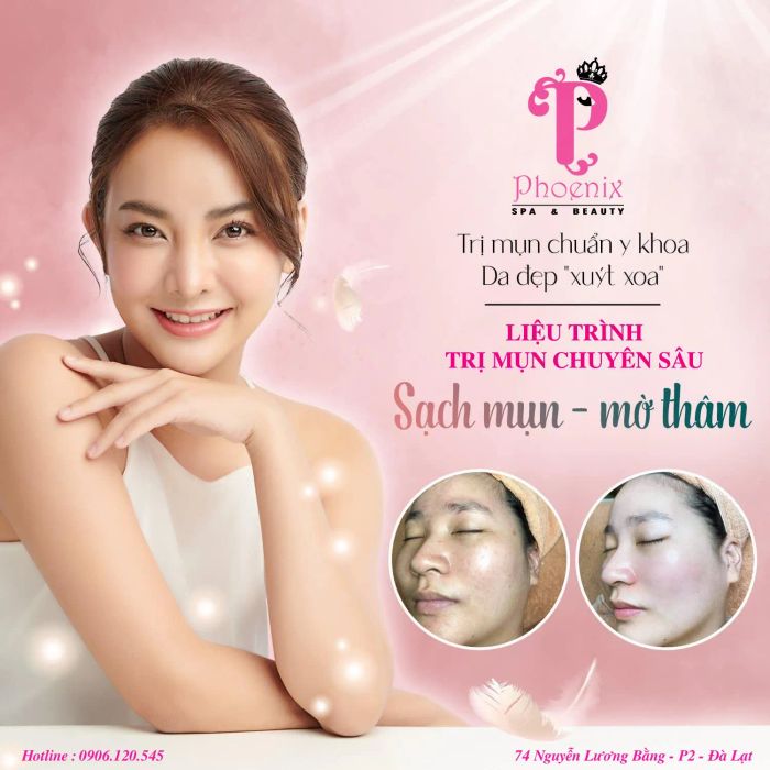 Phoenix Spa & Academy Đà Lạt ảnh 2