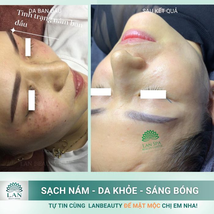 Hình ảnh Trung Tâm Làm Đẹp Lan Spa