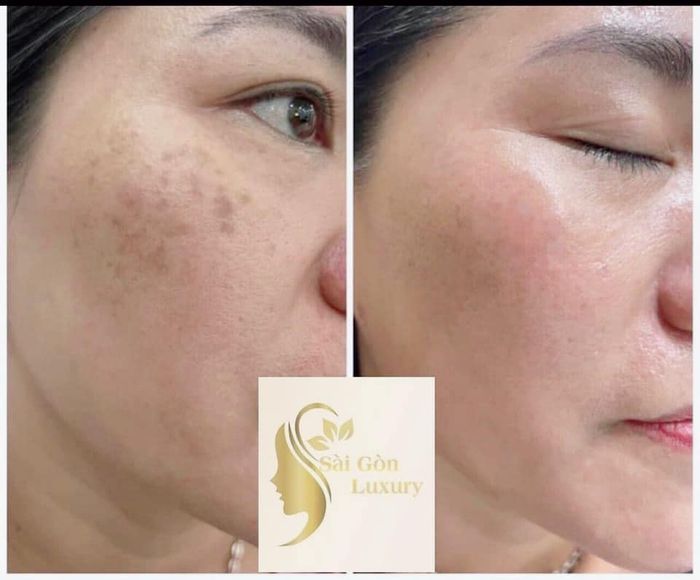 Không gian sang trọng tại Thẩm Mỹ Viện Sài Gòn Luxury