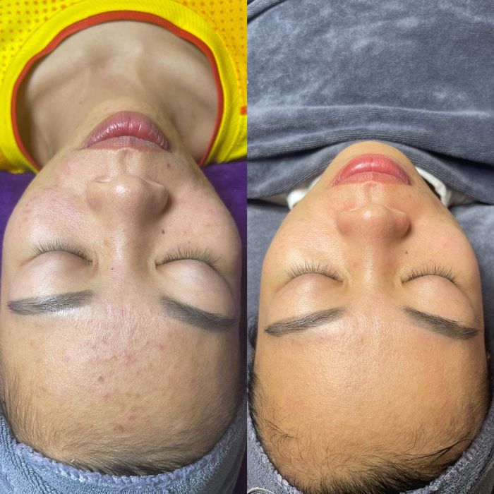 Hình ảnh Le.O Spa Đà Nẵng 2