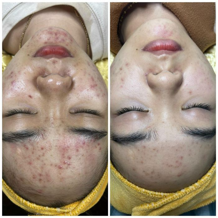 Hình ảnh Naina Spa 1