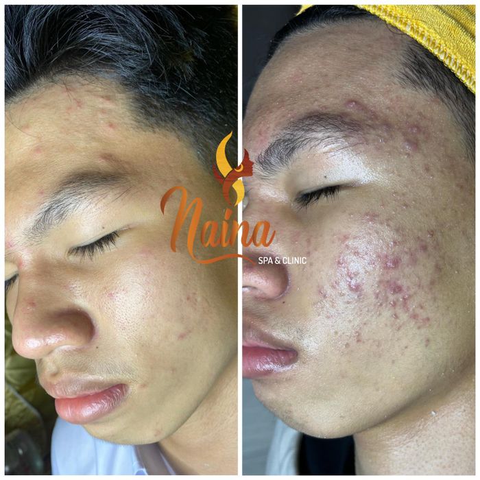 Hình ảnh Naina Spa 2