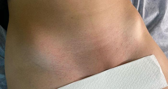 Hình ảnh quy trình wax lông chuyên nghiệp tại Waxing.tinioanh