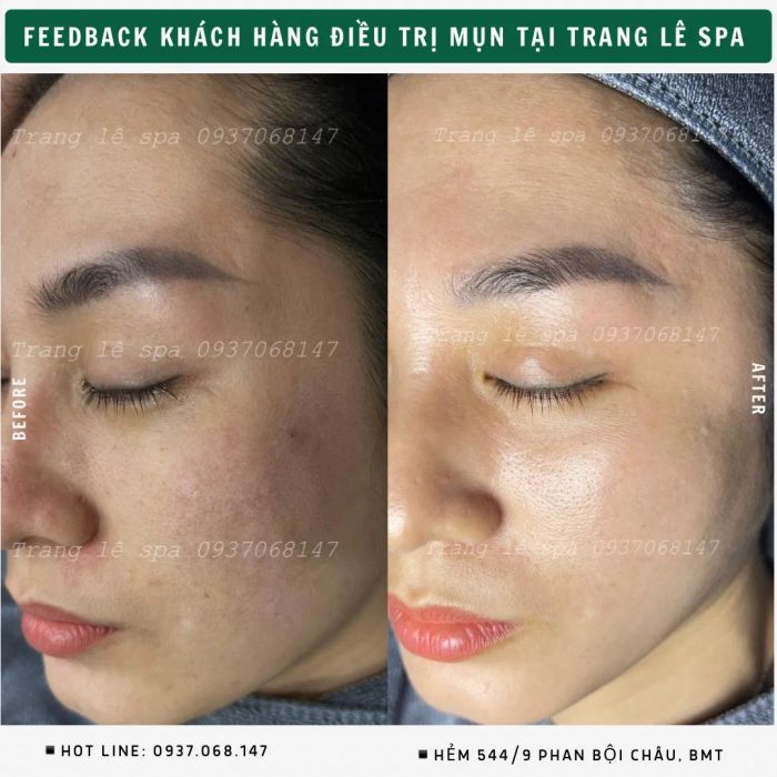 Hình ảnh quy trình chăm sóc da chuyên nghiệp tại Trang Lê Spa