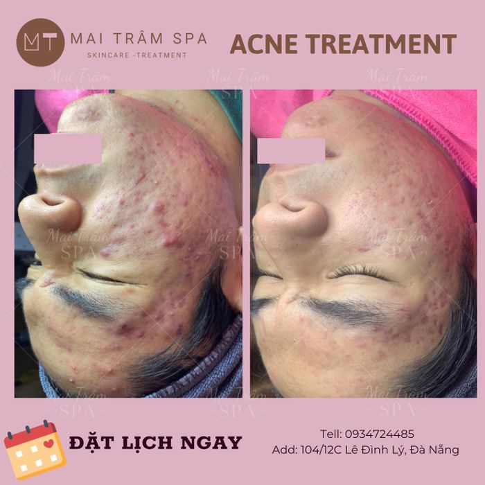 Hình ảnh Mai Trâm Spa 2