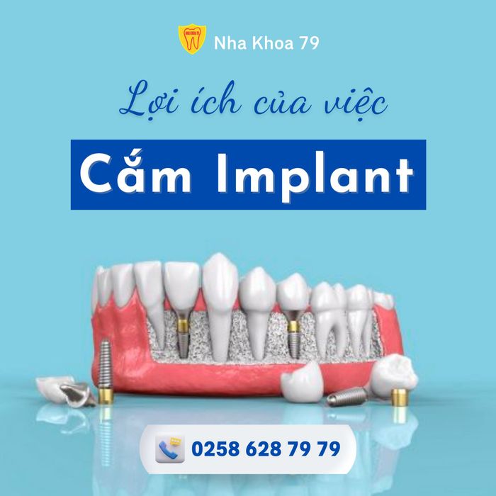 Hình ảnh 2 - Đội ngũ bác sĩ chuyên môn cao tại Nha Khoa 79