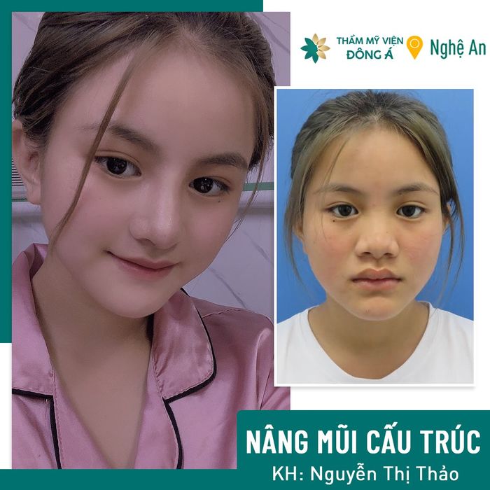 Hình ảnh đội ngũ bác sĩ chuyên gia hàng đầu tại Bệnh viện Thẩm mỹ Đông Á