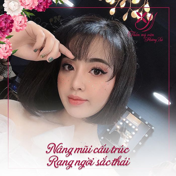 Hình ảnh thực tế quy trình nâng mũi tại Thẩm Mỹ Hường Xô