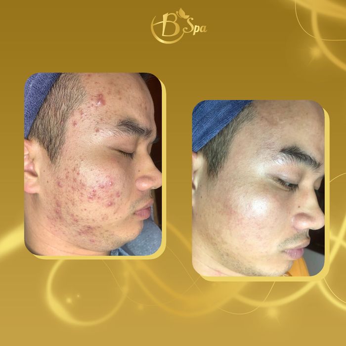 Hình ảnh B Spa Đà Nẵng 2