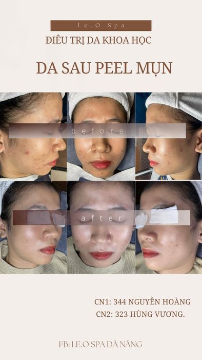 Hình ảnh Le.O Spa Đà Nẵng 1