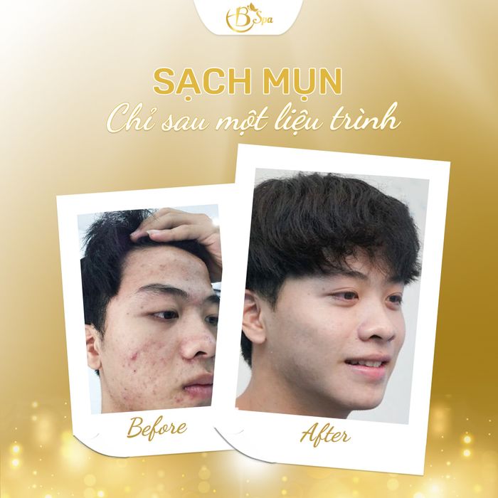 Hình ảnh B Spa Đà Nẵng 1