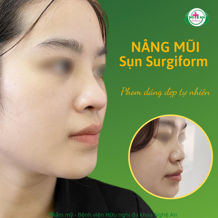 Không gian hiện đại tại Khoa Thẩm Mỹ - Bệnh Viện Hữu Nghị