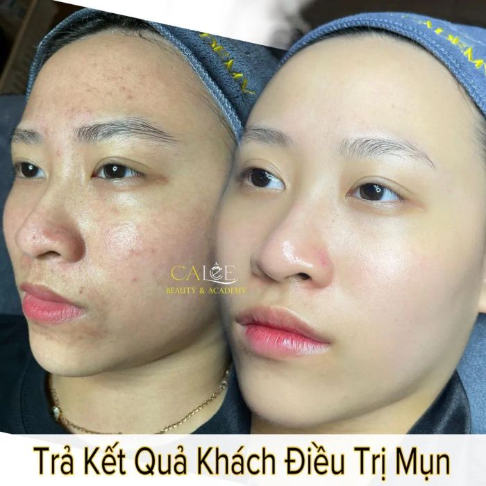 Không gian sang trọng tại Calee Spa - Thẩm Mỹ Viện TP Vĩnh Long