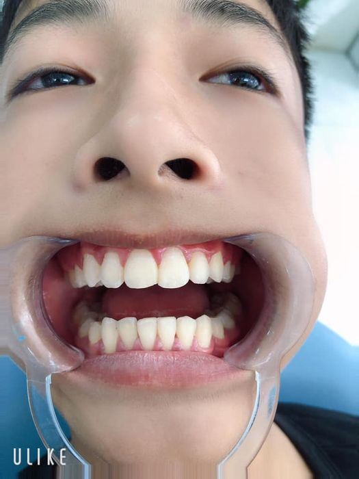 Không gian hiện đại tại Nha Khoa 108 Ninh Bình