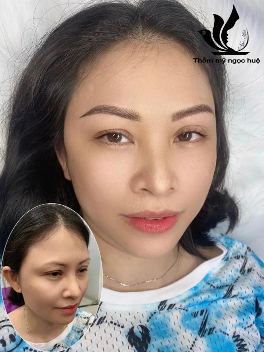Hình ảnh Thẩm Mỹ Ngọc Huệ (2)
