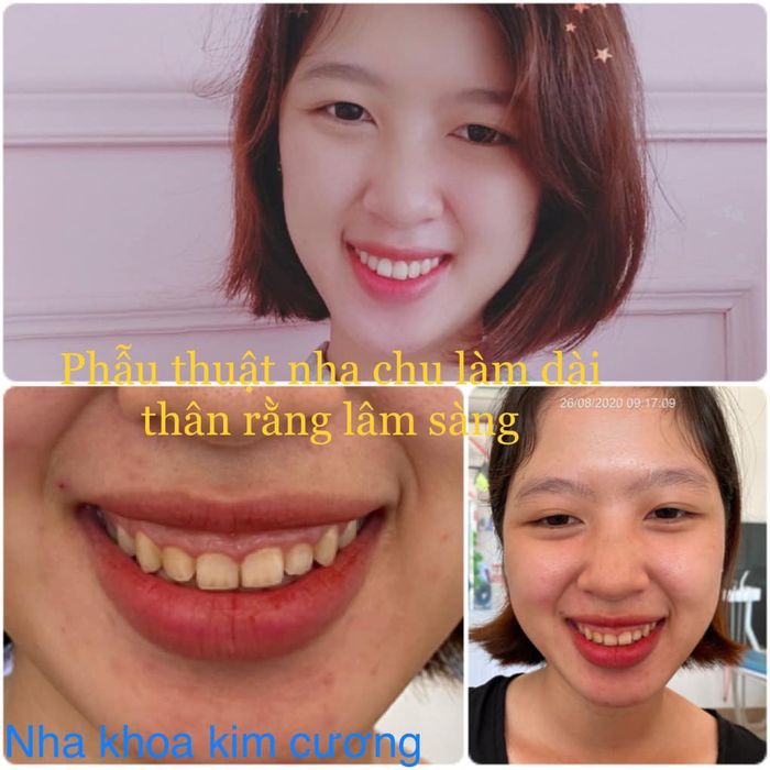 Không gian điều trị tiêu chuẩn tại Nha Khoa Kim Cương (Ảnh 2)