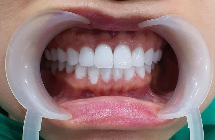 Hình ảnh thực tế Nha Khoa Sunny Smile
