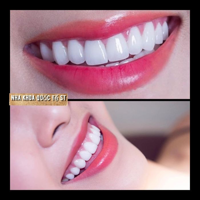 Hệ thống trang thiết bị tân tiến tại Nha Khoa Quốc Tế ST
