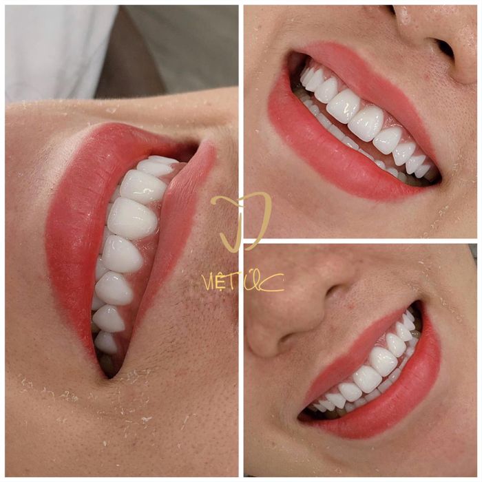 Hệ thống trang thiết bị hiện đại tại Nha Khoa Việt Úc (Ảnh 2)