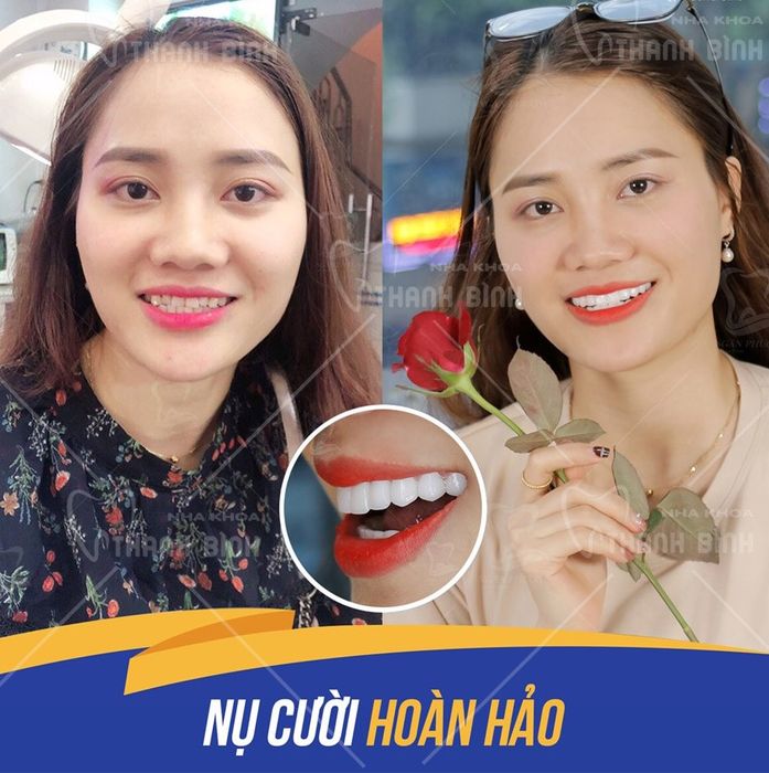 Hình ảnh phòng khám Nha khoa Thanh Bình