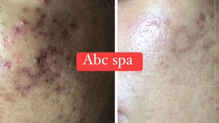 Quy trình chăm sóc da chuyên nghiệp tại ABC Spa & Clinic