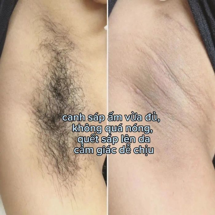 Trải nghiệm dịch vụ cao cấp tại Gentle Waxing