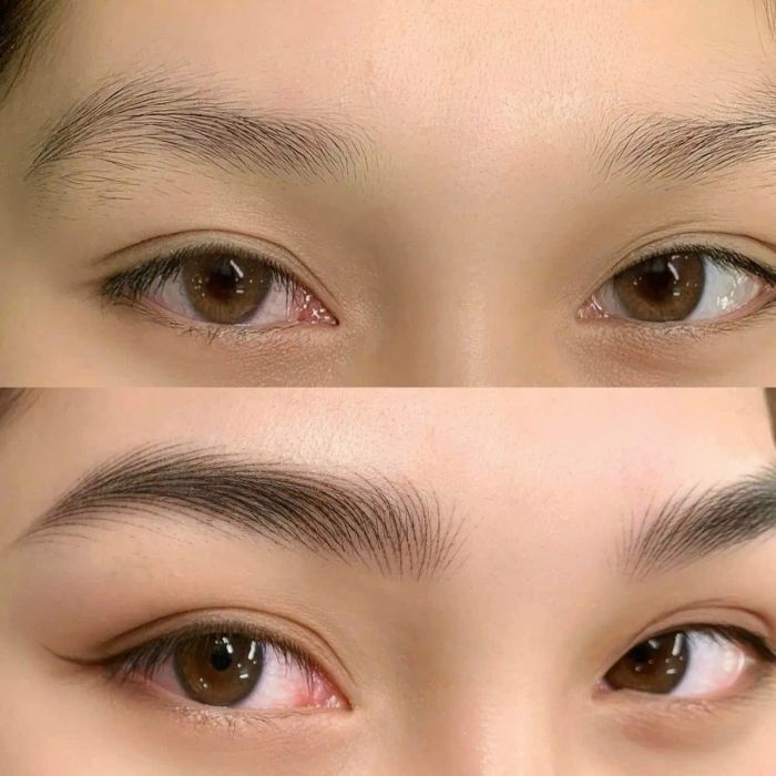 Hình ảnh thực tế dịch vụ tại Linh Anh Clinic
