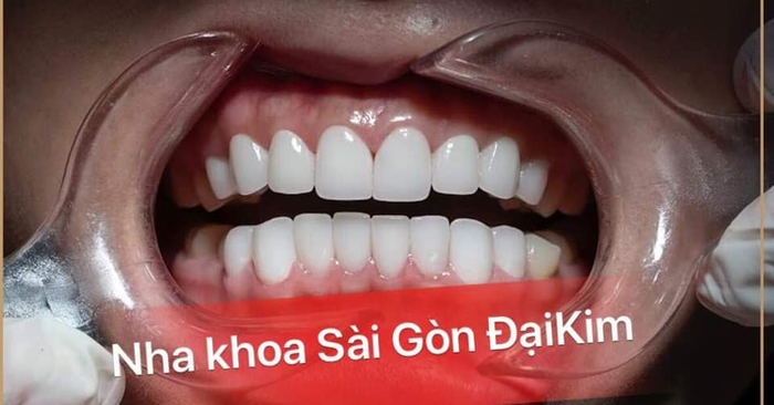 Không gian hiện đại tại Nha khoa Sài Gòn Đại Kim