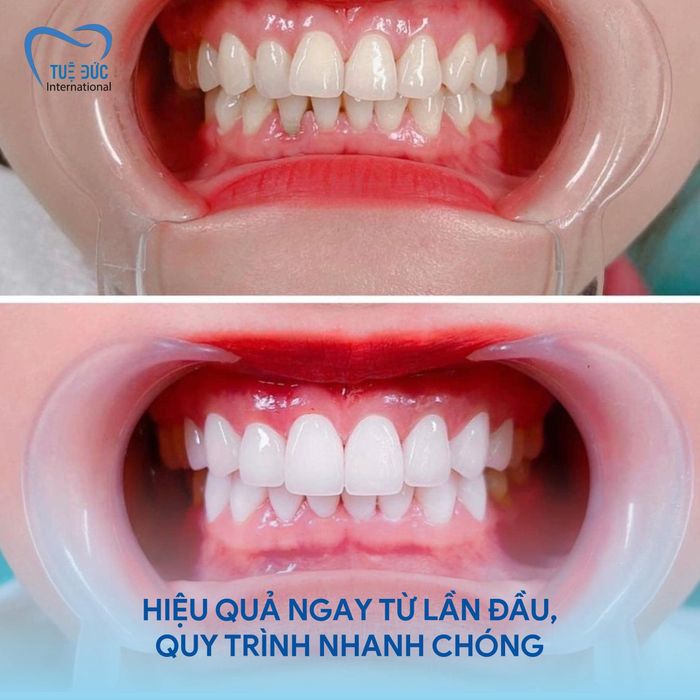 Hình ảnh thực tế Nha Khoa Quốc Tế Tuệ Đức