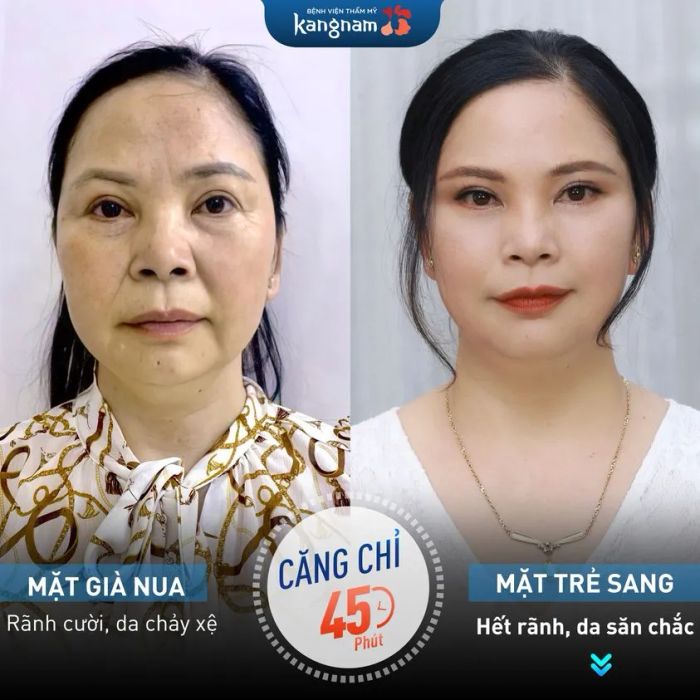 Không gian sang trọng tại Bệnh viện thẩm mỹ Kangnam