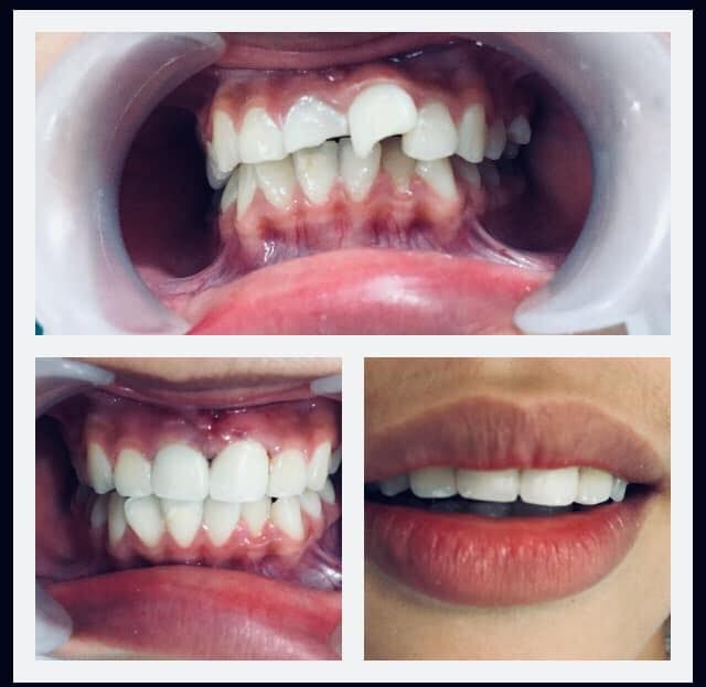 Hệ thống trang thiết bị tân tiến tại Nha Khoa Răng Ngọc