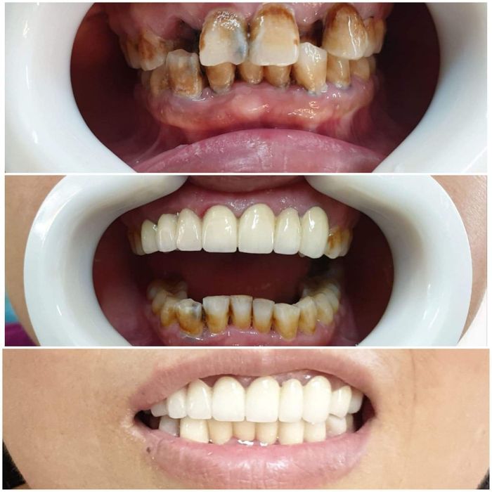 Hệ thống trang thiết bị hiện đại tại Nha Khoa Răng Xinh - Hà Tĩnh