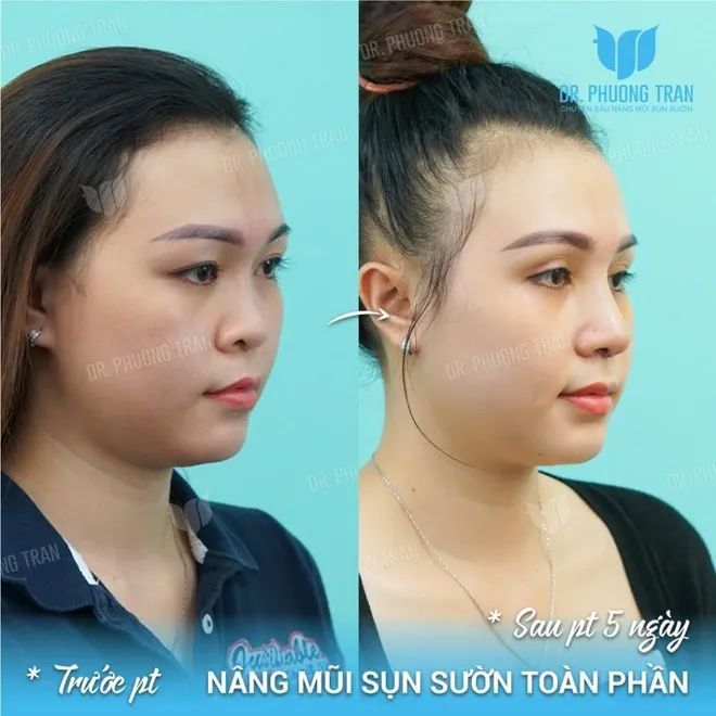 Bác Sĩ Trần Phương - Khoảnh khắc vàng trong phẫu thuật thẩm mỹ