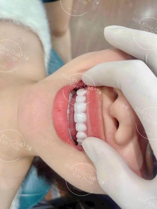 Hình ảnh phòng điều trị hiện đại tại Nha Khoa Việt Pháp