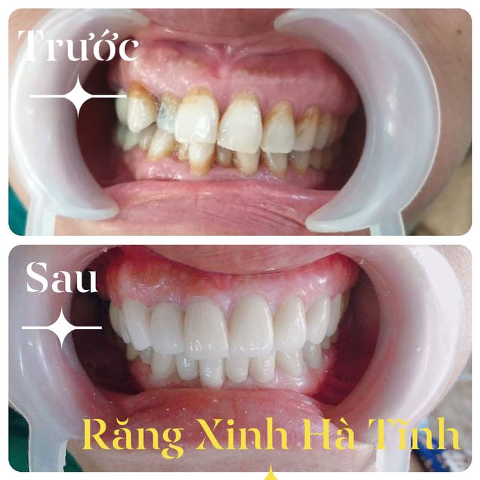 Không gian sang trọng và hiện đại tại Nha Khoa Răng Xinh