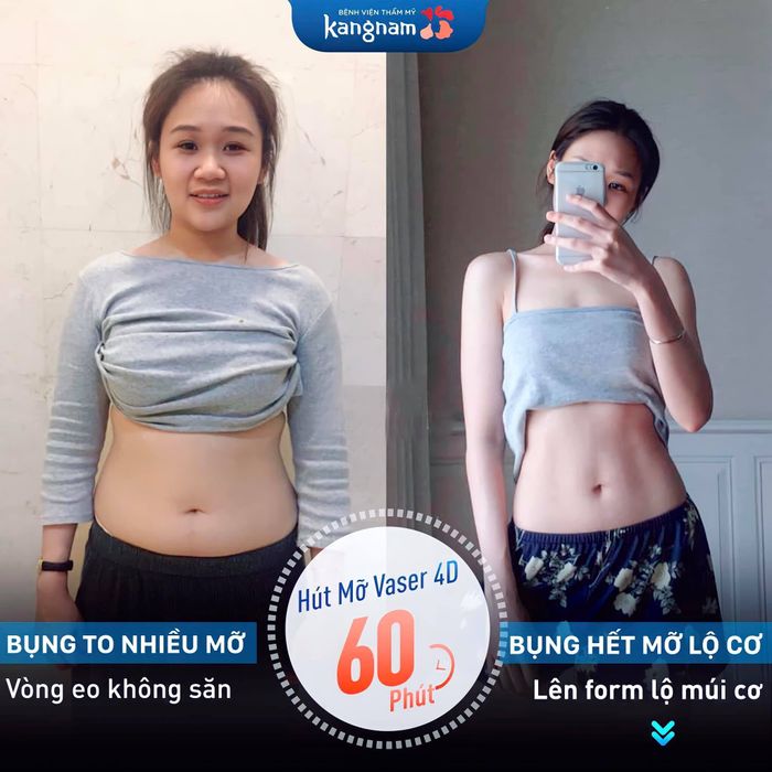Bệnh viện thẩm mỹ Kangnam hình ảnh 1
