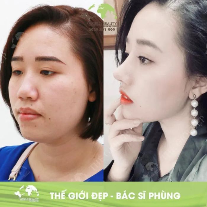 Bác sĩ Nguyễn Văn Phùng - Khoảnh khắc vàng trong phẫu thuật thẩm mỹ
