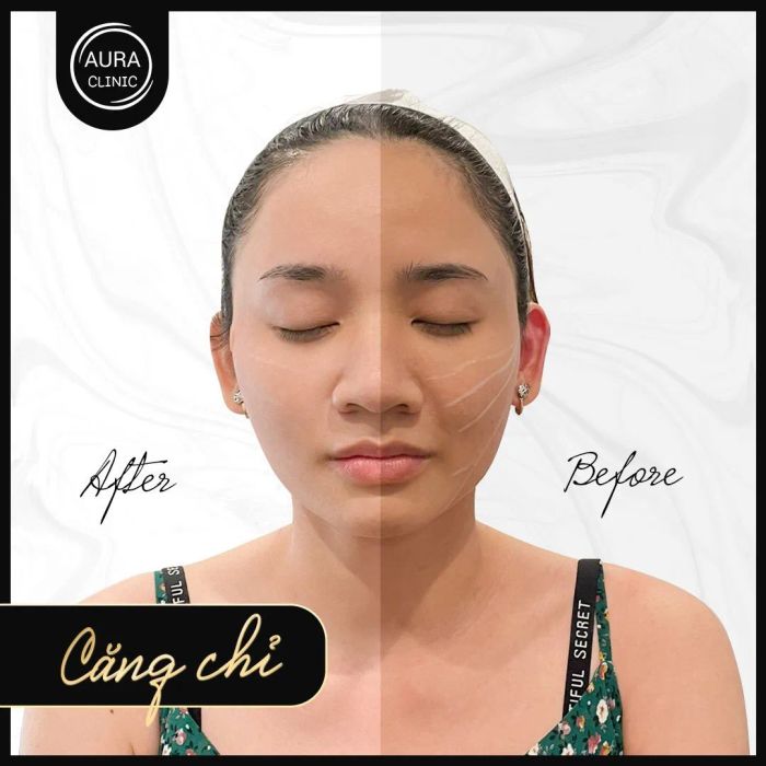 Quy trình chuẩn Hàn tại Aura Beauty Clinic - ABC
