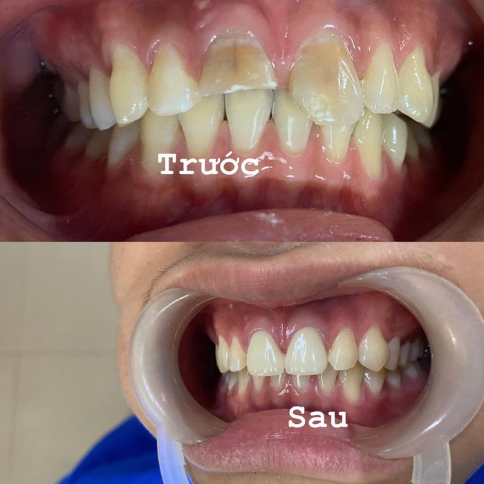 Hệ thống trang thiết bị tiên tiến tại Nha Khoa Bảo Linh