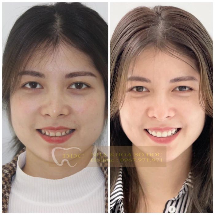 Nha Khoa Số DDC - Hình ảnh 2