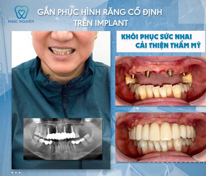 Không gian phòng khám hiện đại tại Nha khoa Phúc Nguyên