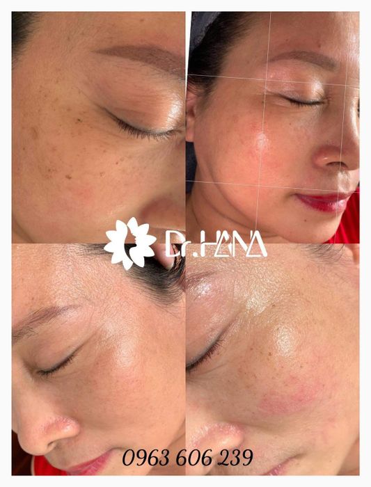 Phòng điều trị chuyên sâu tại Viện thẩm mỹ Dr.Hana - Ảnh 3