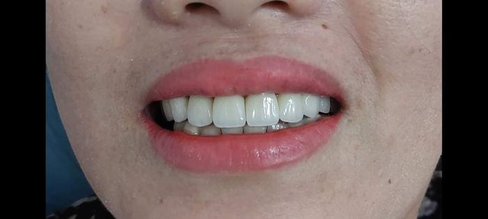 Hình ảnh cơ sở vật chất hiện đại tại Nha Khoa Bác sĩ Chiến